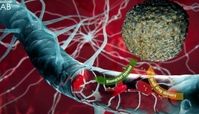 جایگزینی سونوگرافی و آزمایش خون با نمونه برداری‌های تهاجمی مغز