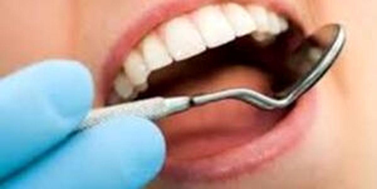 دندان را پر کنیم یا روکش؟