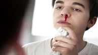 علت خون دماغ شدن چیست و چه راه درمانی دارد ؟