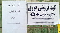 " کبدفروشی" ، دوئل مرگ و آبرو…