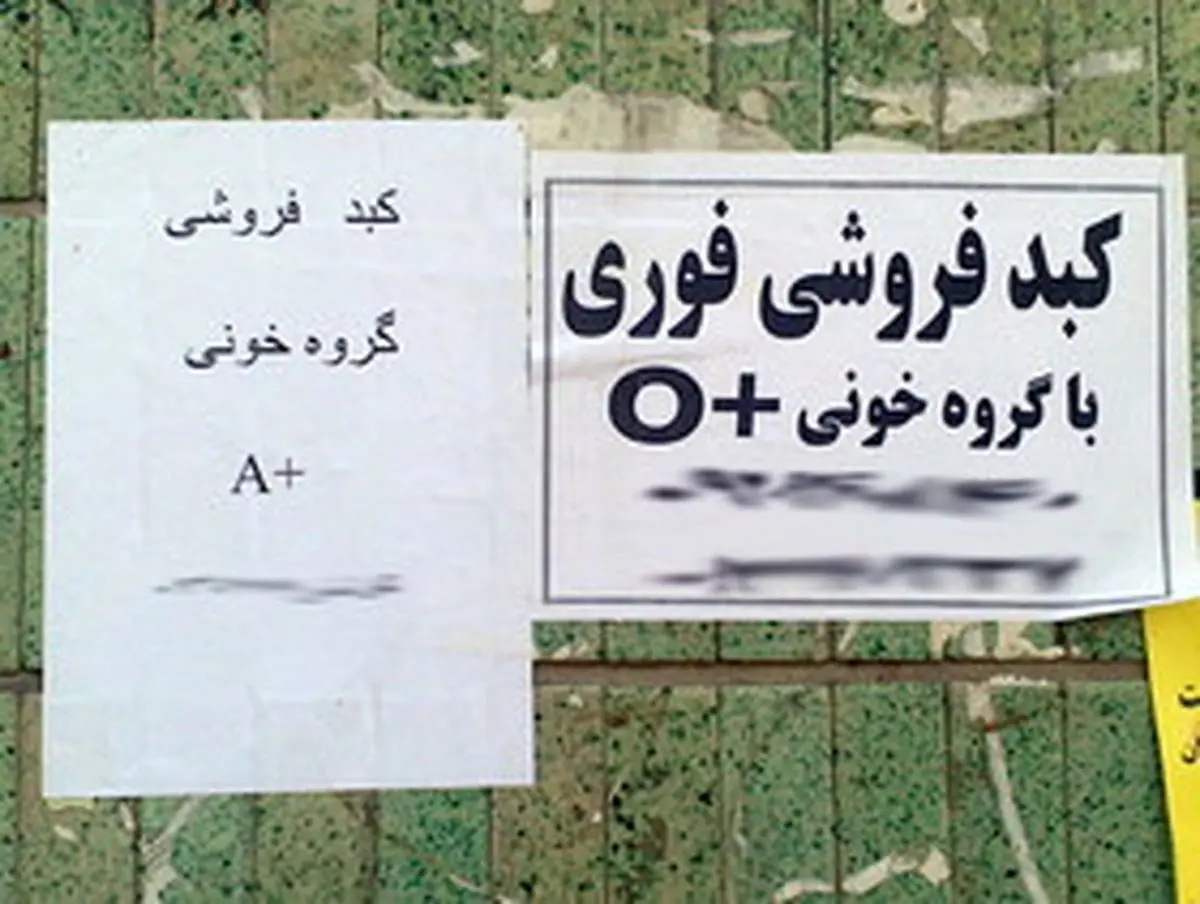 " کبدفروشی" ، دوئل مرگ و آبرو…
