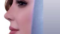 ظاهر جدید نیوشا ضیغمی پس از جراحی زیبایی + عکس