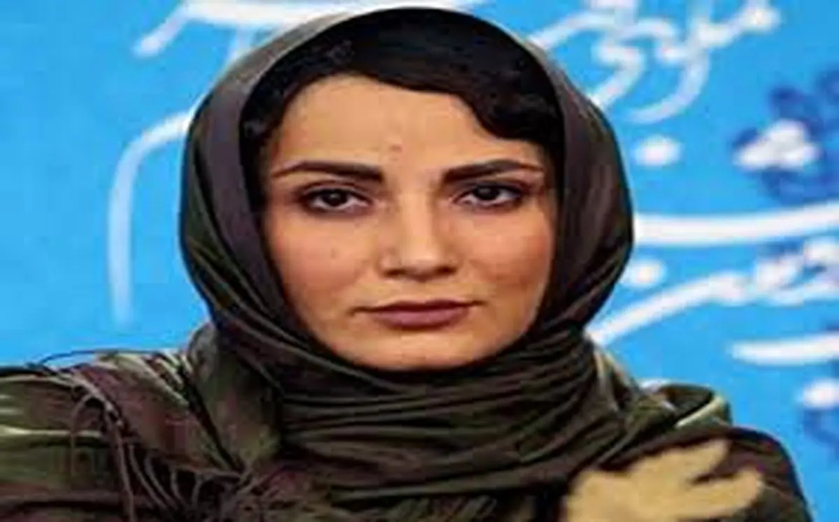قیافه جالب «سمیرا حسن‌پور» در دندانپزشکی