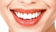 آیا جنس دندان به ژنتیک مرتبط است؟