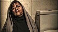 صورت چاقو خورده خانم بازیگر + عکس