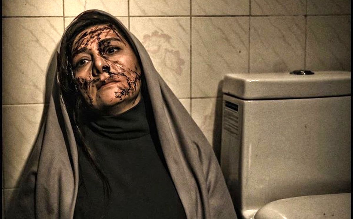 صورت چاقو خورده خانم بازیگر + عکس