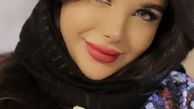 	جراحی زیبایی بینی با دکتر ضیغمی
