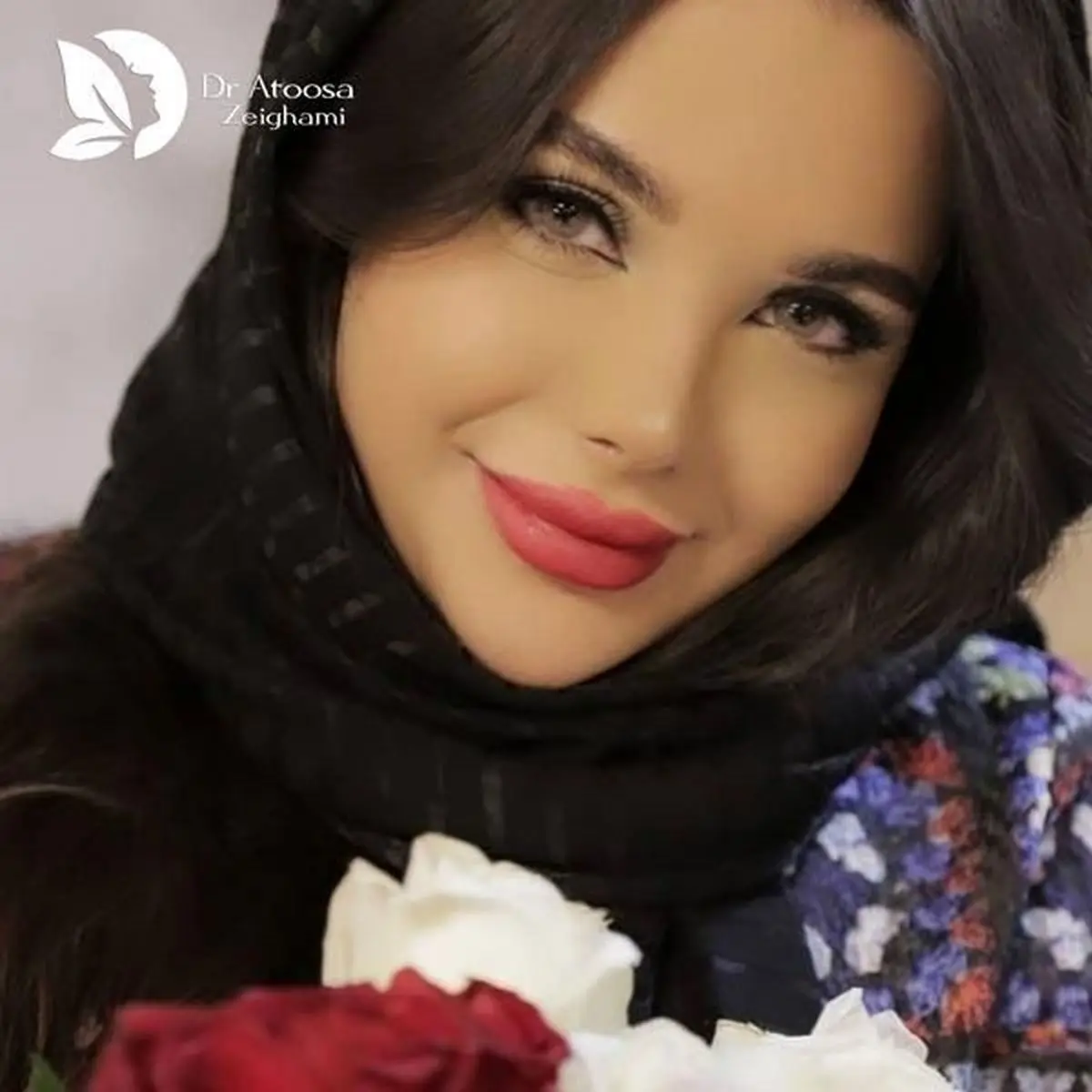 	جراحی زیبایی بینی با دکتر ضیغمی