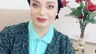 تغییر ظاهر صبا راد پس از بازگشتش از ترکیه + عکس
