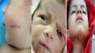 12 پرونده جنجالی اشتباهات پزشکی در ایران 