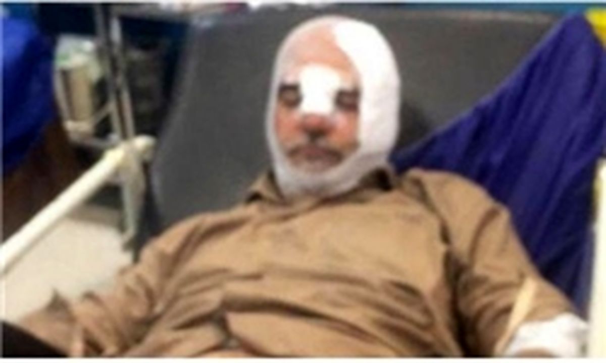 حسین‌ الله‌کرم در حادثه مشکوک تصادف به شدت مصدوم شد