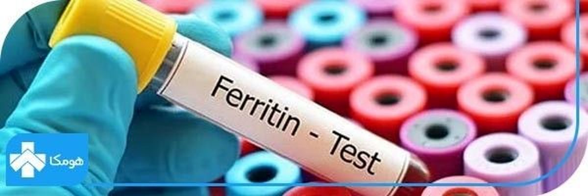 سنجش میزان ذخایر آهن در بدن با آزمایش Ferritin + تفسیر آزمایش Ferritin