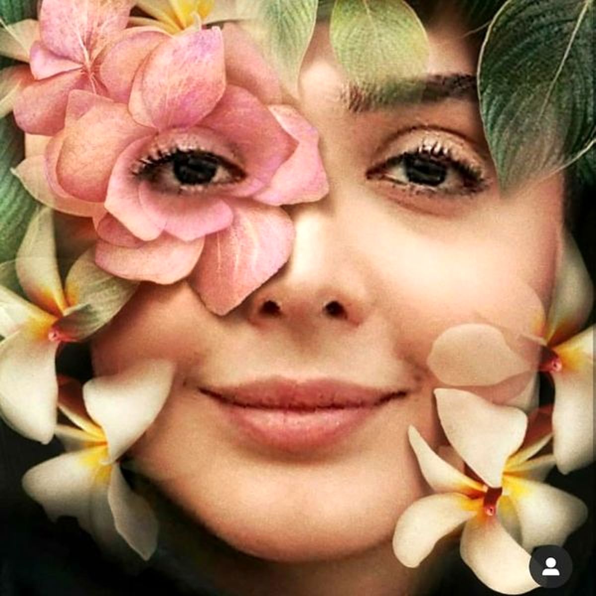 صورت گلبارون شده خانم بازیگر + عکس