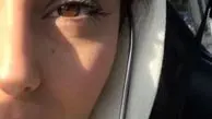 عکس بازیگر جوان سریال جراحت از نمای نزدیک
