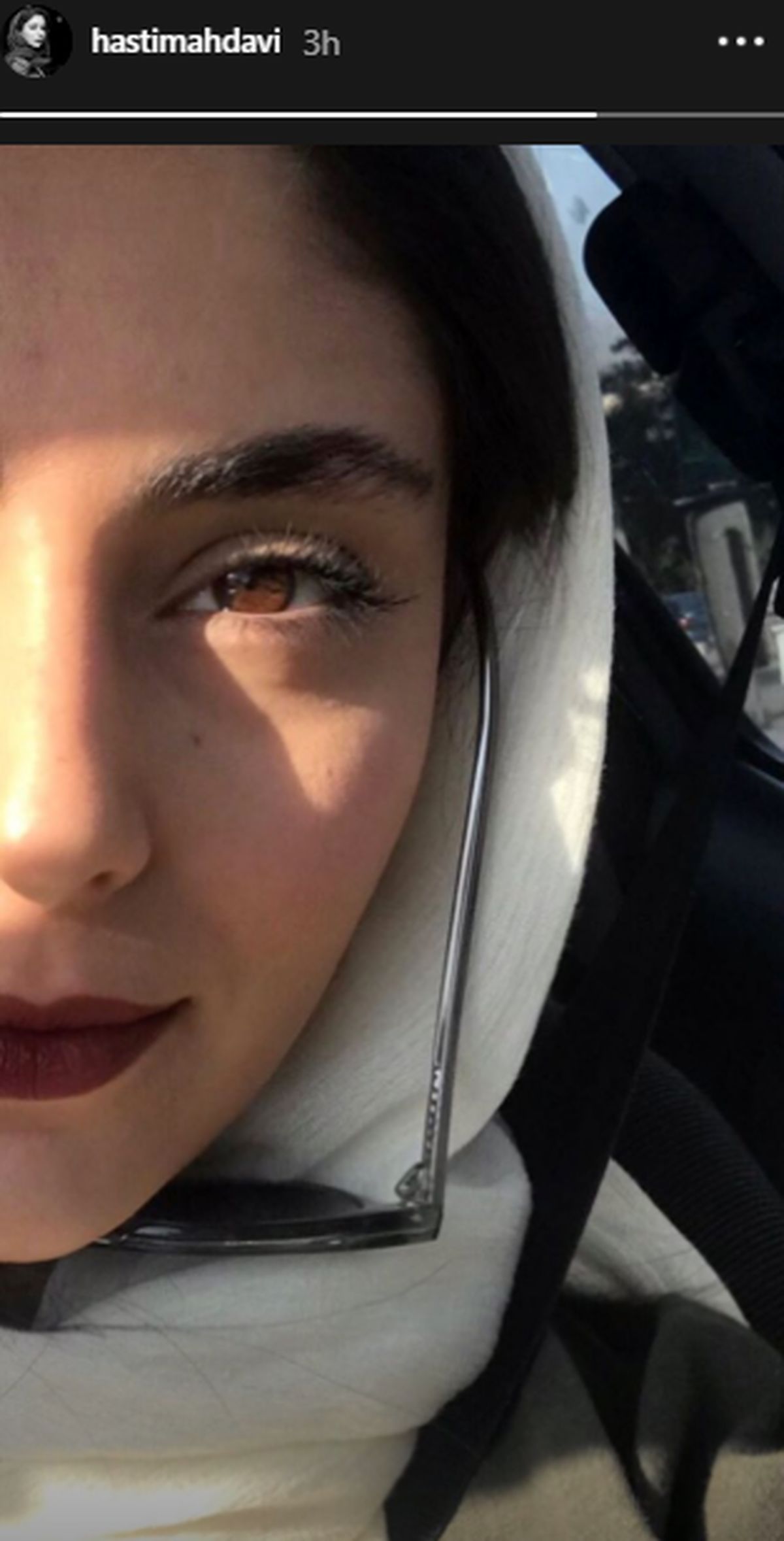 عکس بازیگر جوان سریال جراحت از نمای نزدیک