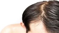 
علت چربی مو سر چیست؟
