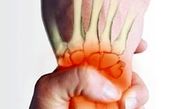 چگونه به آرتروز مبتلا نشویم