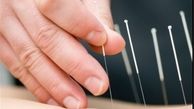 نحوه عملکرد طب فشاری در کنترل سردردها