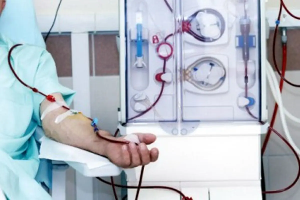مرگ ۱۸ هزار و ۳۳۱ بیمار کلیوی به علت کمبود دستگاه دیالیز!