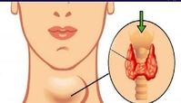 ۱۰ نشانه کار نکردن غده تیروئید + توضیحات