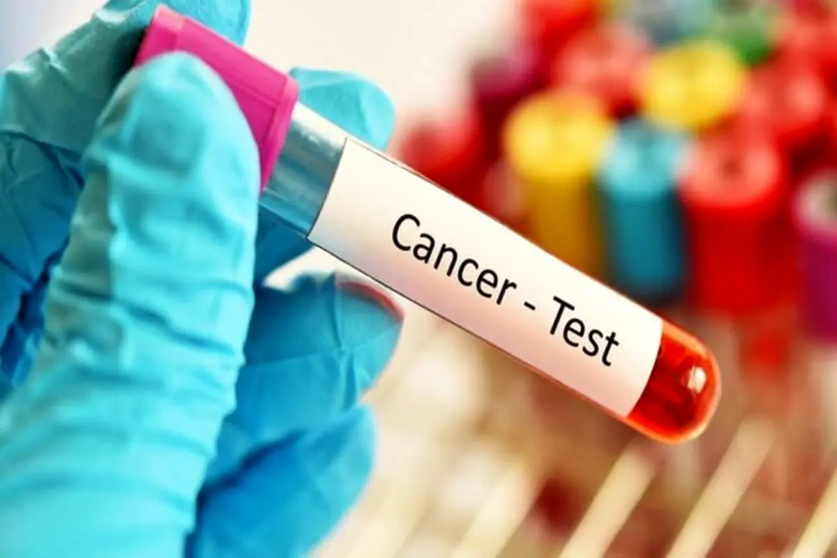 پوشش بیمه ۳ سرطان شایع در دستور کار / برقراری پوشش آزمایشات HPV