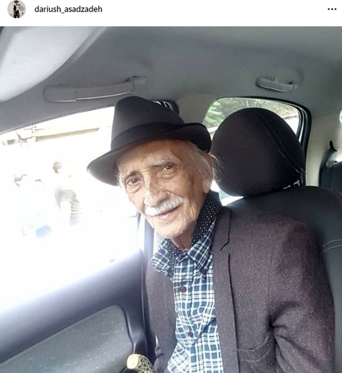 عکس بازیگر "خانه سبز" با چهره ای شکسته