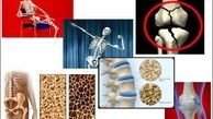 ۳ راه طبیعی برای پیشگیری از پوکی استخوان