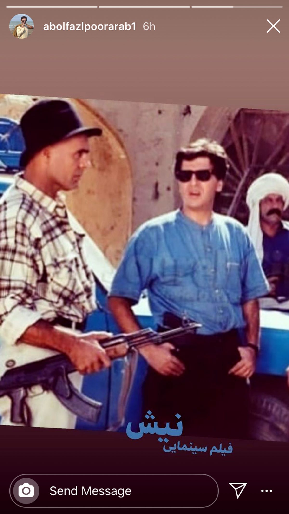 نیش بازیگر مشهور + عکس