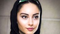  ترلان پروانه، مات و مبهوت/عکس