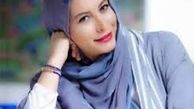 فریبا نادری با صورت سوخته!/عکس
