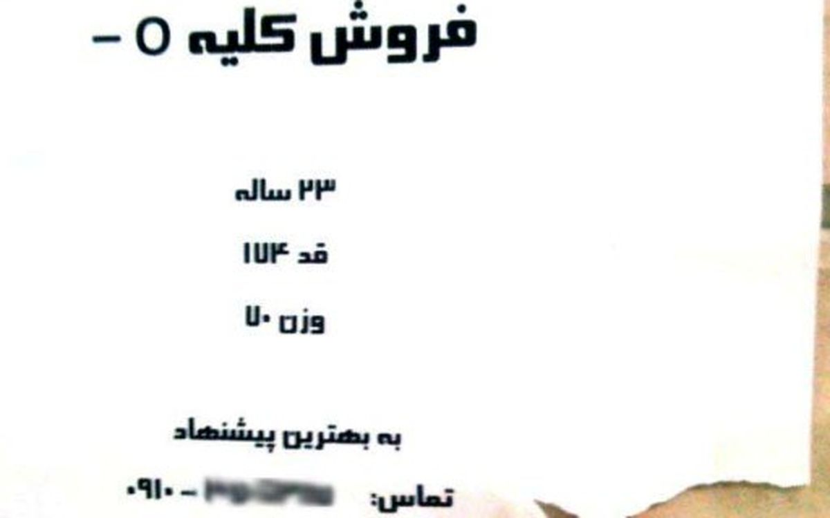 حداقل 25 هزار نفر بیمار دیالیزی در کشور وجود دارند/ راه اندازي سامانه اهداي كليه زير نظر وزارت بهداشت