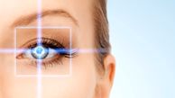 بیماری قوز قرنیه و علائم آن
