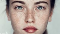 از بین بردن لک صورت با 18 راهکار خانگی و پزشکی