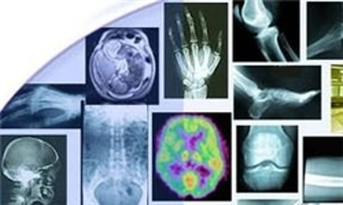 پزشکان صلاحیت خدمات رادیولوژی ندارند