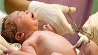 درمان زخم‌ پای دیابتی و زخم سوختگی با «پرده آمنیوتیک»
