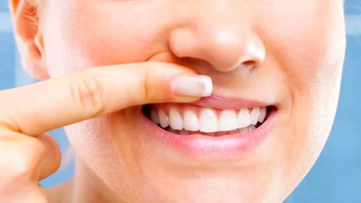 دلیل لق شدن دندان ها جیست؟