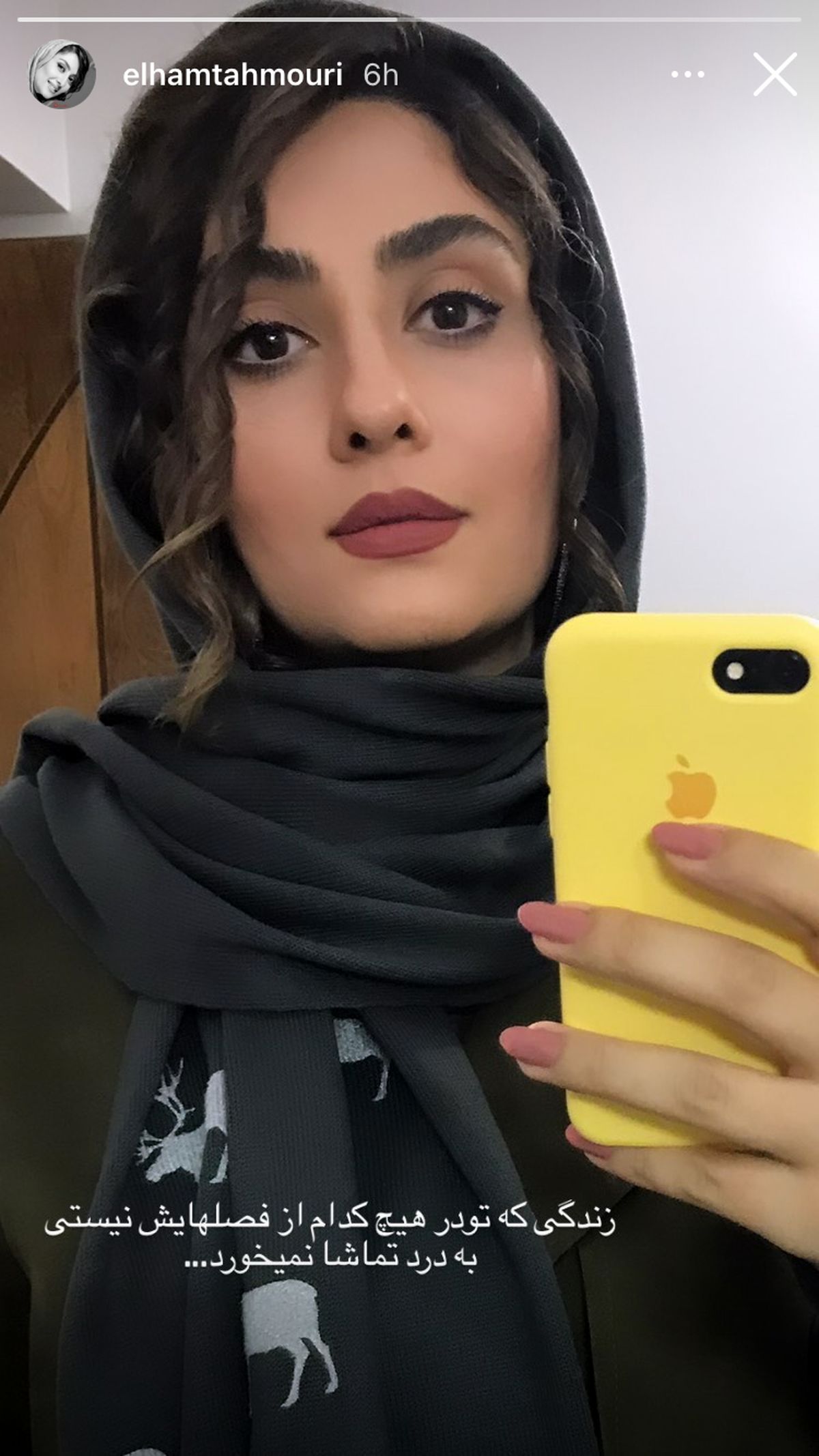 ظاهر جدید الهام طهموری + عکس