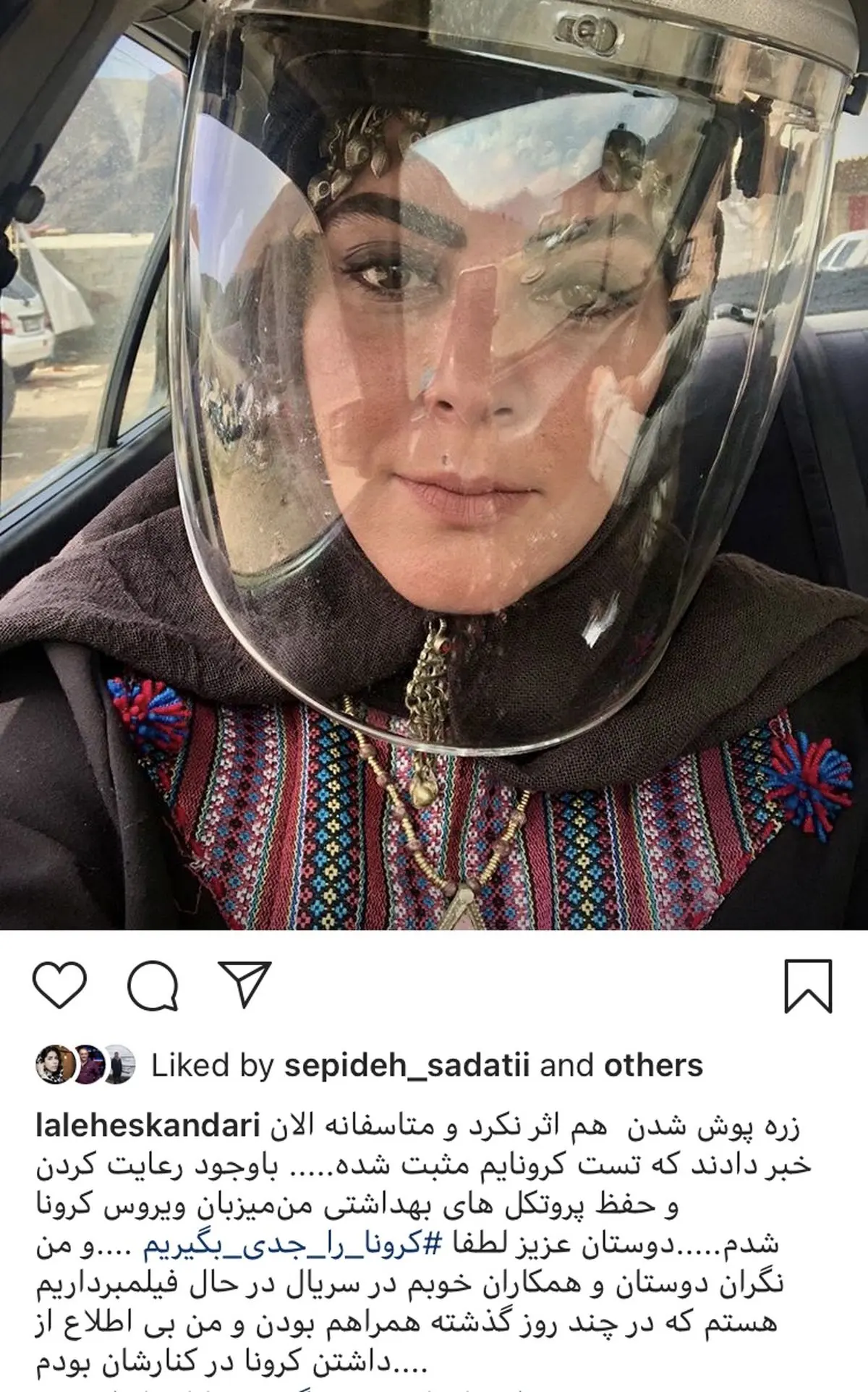 لاله اسکندی هم‌‌ کرونا گرفت + عکس