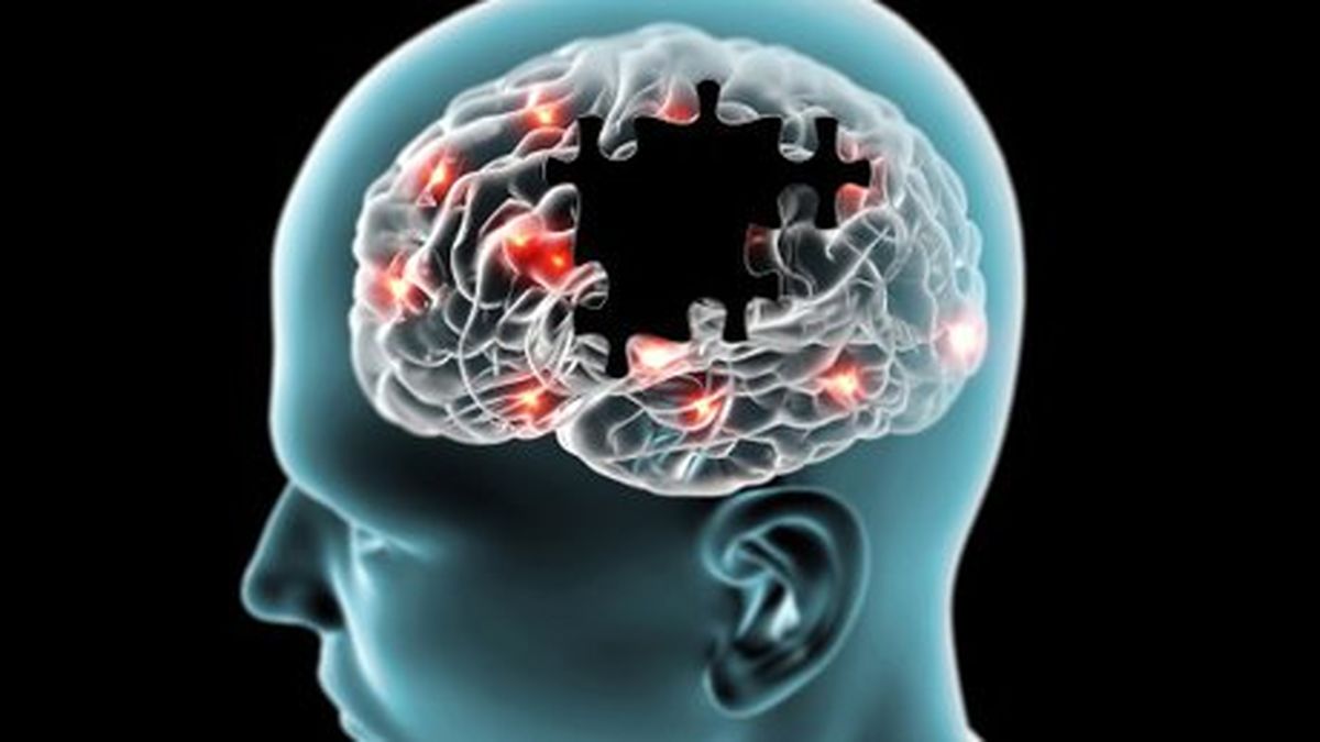 راه طبیعی مقابله با آلزایمر 
