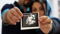 خطرات حذف غربالگری مادران باردار