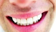 بهترین جایگزین برای دندان‌های از دست رفته
