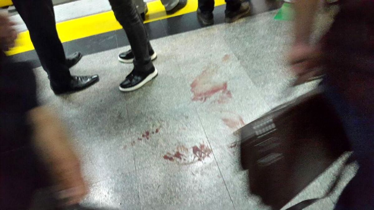 حمله زنی با تیغ برش در فرانسه 