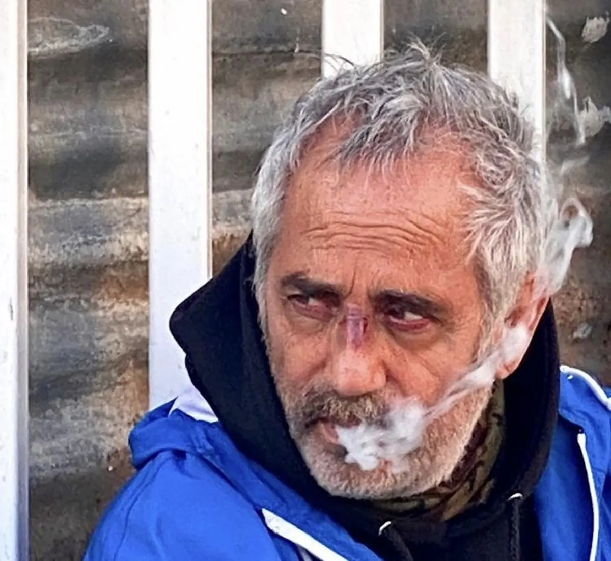مجید مظفری زخمی شد + عکس