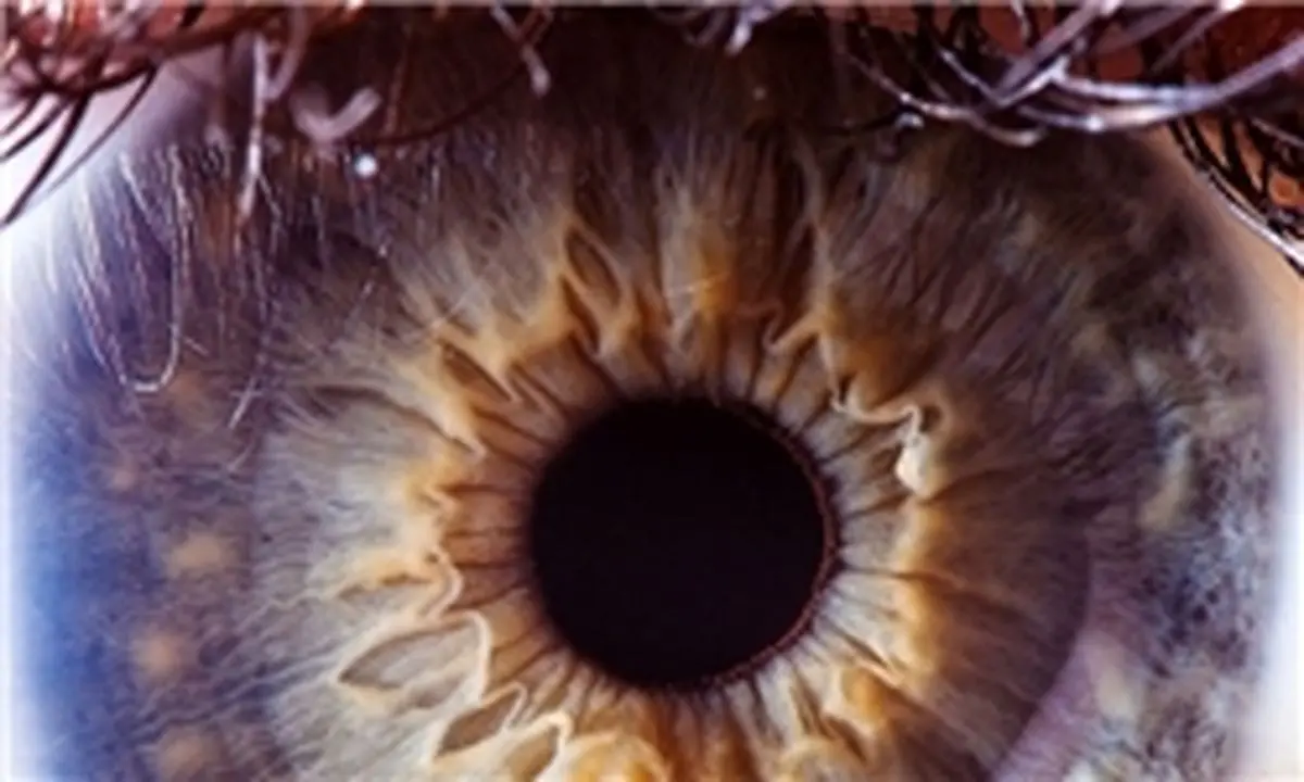 نشانه‌های ابتلا به سرطان چشم 