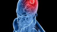 هوش مصنوعی تومور مغزی را ردیابی می کند