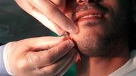 سوراخ شدن عجیب صورت پسر تهرانی به دست خود