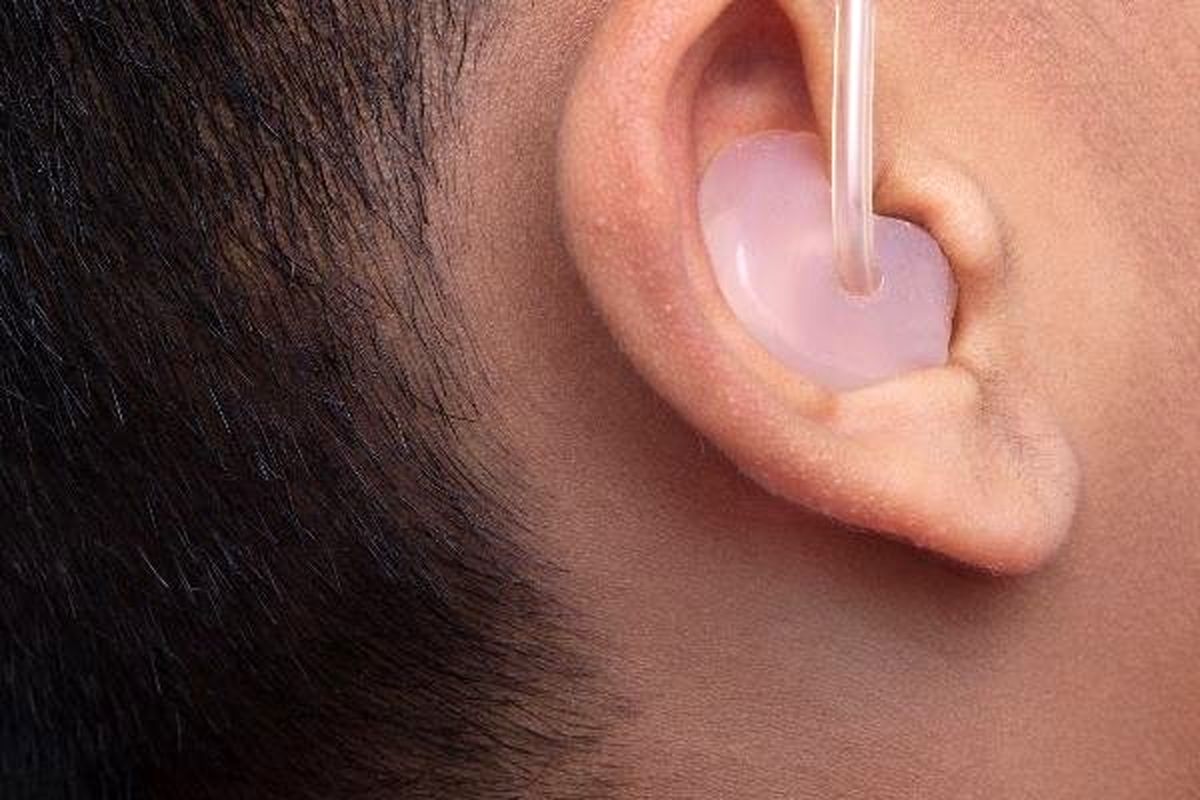 پوشش هزینه سمعک برای نوزادان و کودکان توسط بیمه سلامت