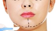 آرمیتا به علت ایست‌قلبی جان خود را از دست داد/ زنانی که اعتماد به نفس دارند کمتر جراحی زیبایی می‌کنند
