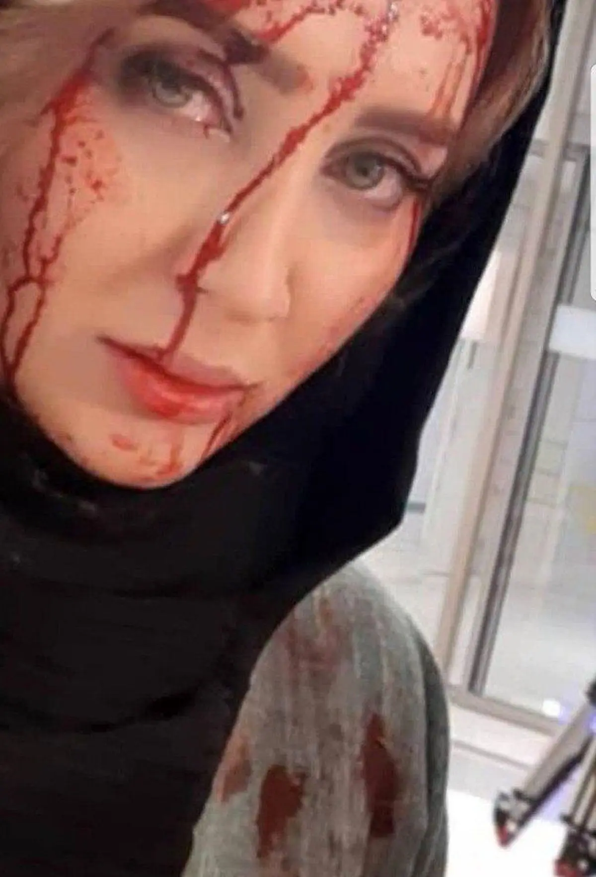 خانم بازیگر با سر شکسته و صورت خونین+عکس