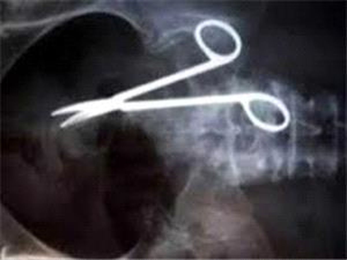  جاماندن قیچی در بدن بیمار!